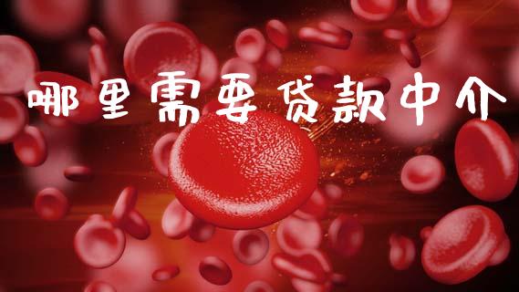 哪里需要贷款中介_https://www.apanben.com_财经资讯_第1张